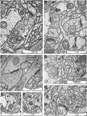 The Synaptic Dysregulation in Adolescent Rats Exposed to Maternal Immune Activation